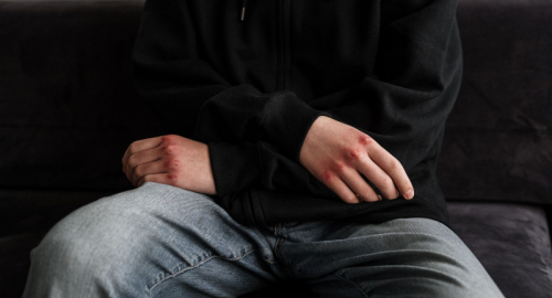 Estremismo online, l�Europa teme una nuova violenza tra i giovanissimi